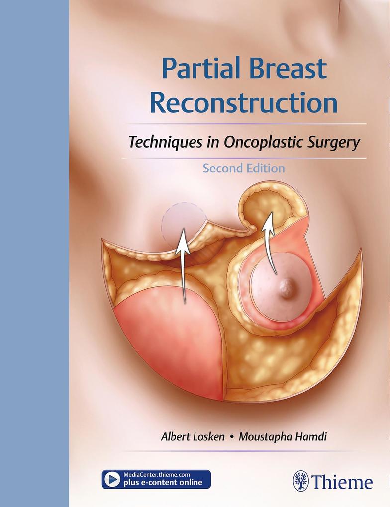 Produktbild: Partial Breast Reconstruction