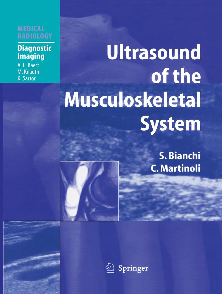 Produktbild: Ultrasound of the Musculoskeletal System | Stefano Bianchi, Carlo Martinoli