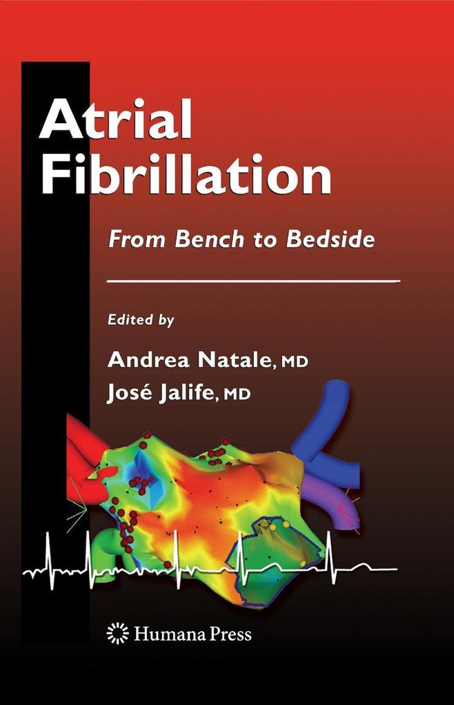 Produktbild: Atrial Fibrillation