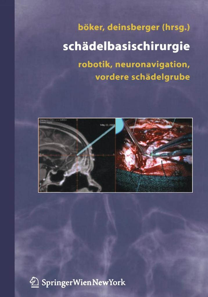 Produktbild: Schädelbasischirurgie