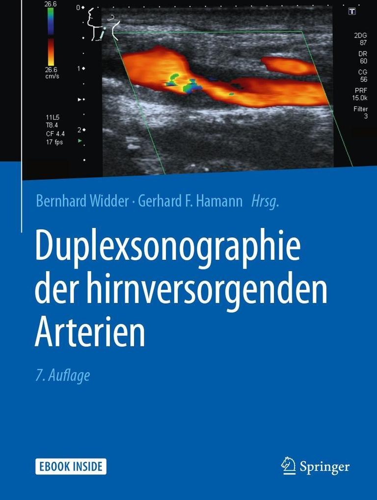Produktbild: Duplexsonographie der hirnversorgenden Arterien