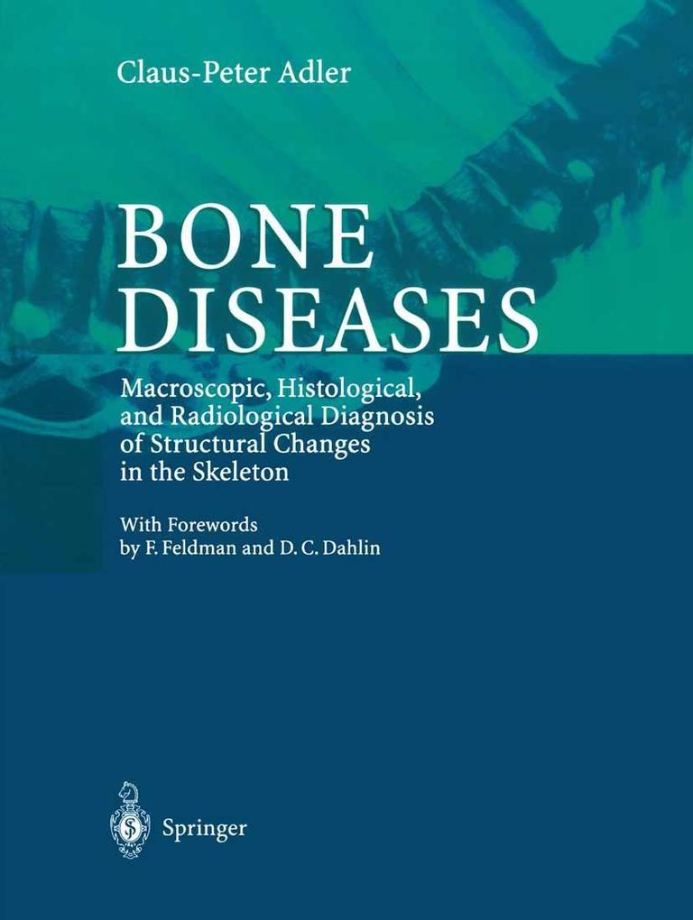 Produktbild: Bone Diseases | Claus-Peter Adler