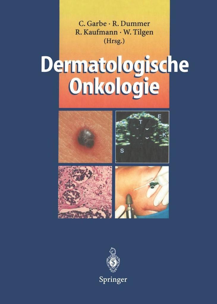 Produktbild: Dermatologische Onkologie