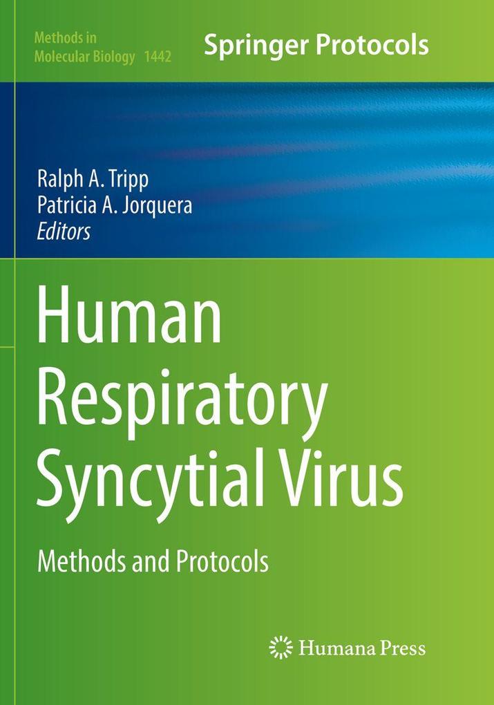 Produktbild: Human Respiratory Syncytial Virus
