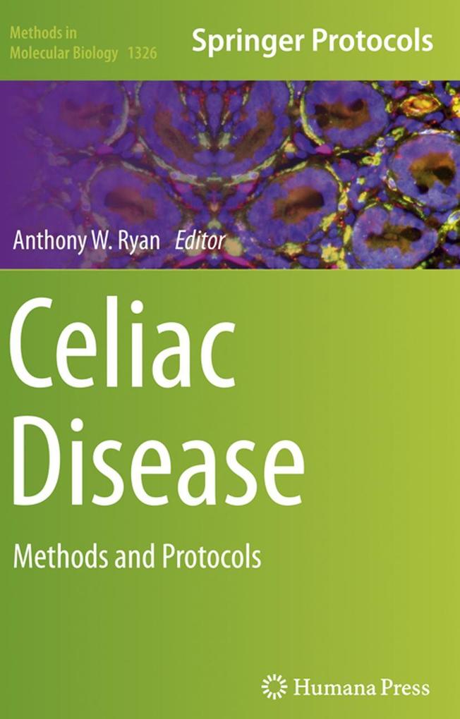 Produktbild: Celiac Disease