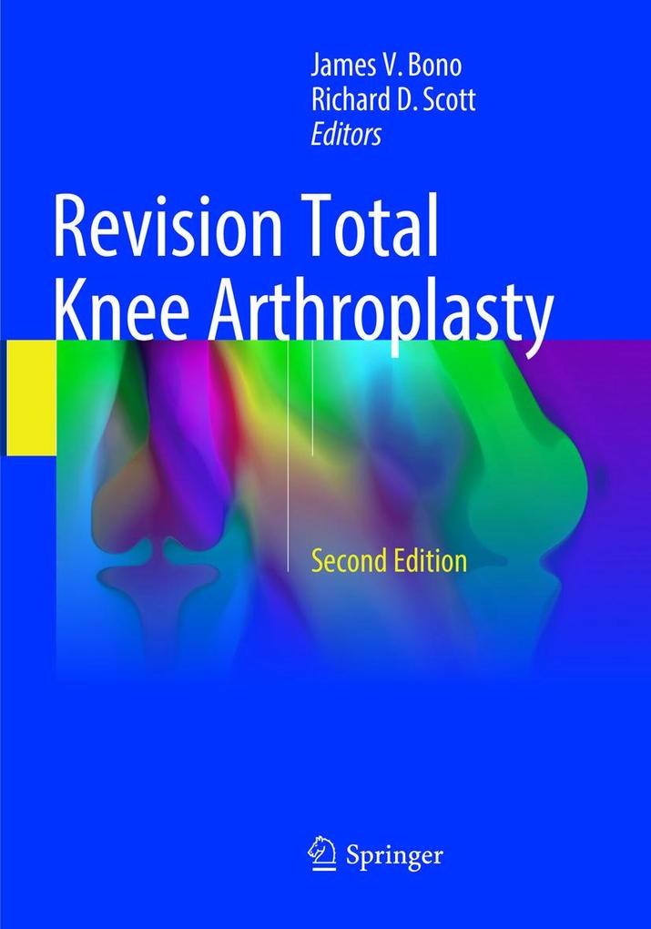 Produktbild: Revision Total Knee Arthroplasty