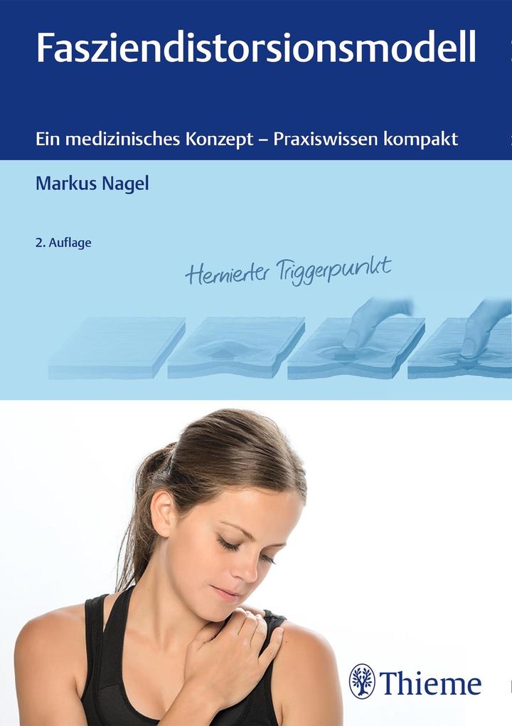 Produktbild: Fasziendistorsionsmodell | Markus Nagel