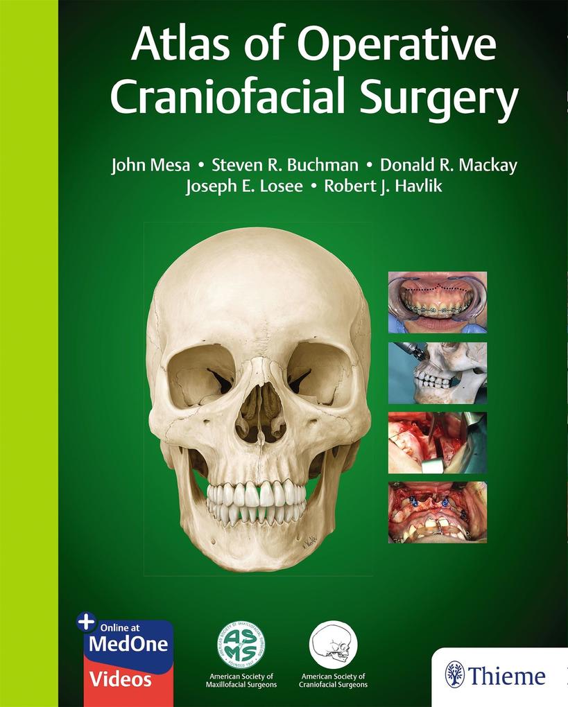 Produktbild: Atlas of Operative Craniofacial Surgery