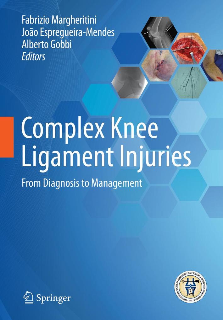Produktbild: Complex Knee Ligament Injuries