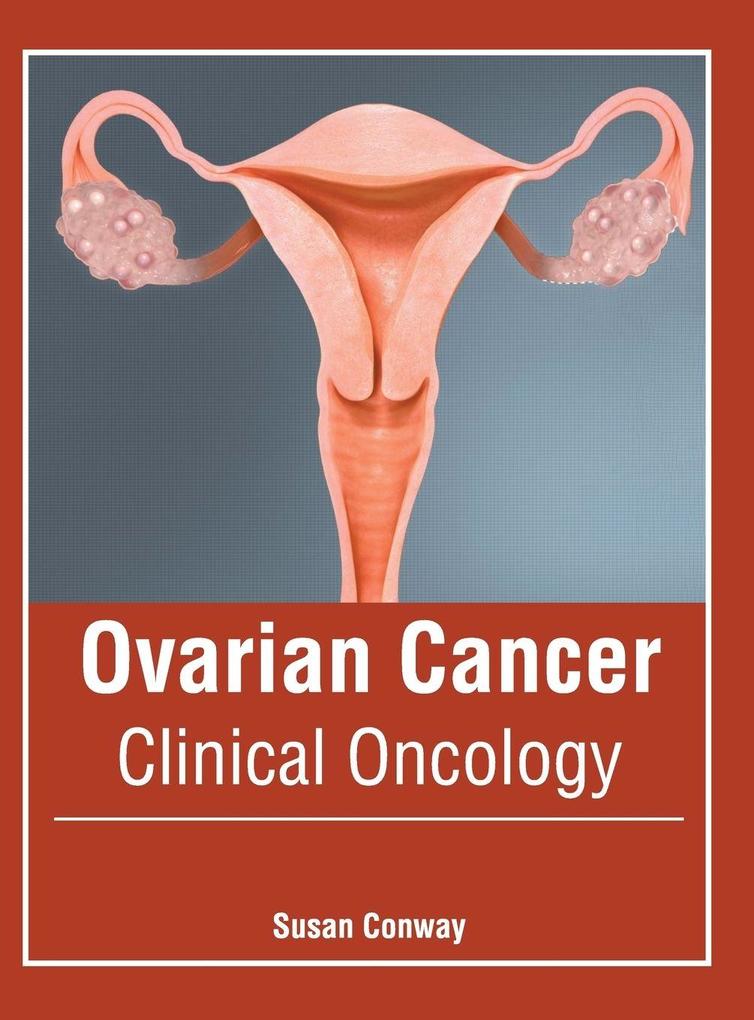 Produktbild: Ovarian Cancer