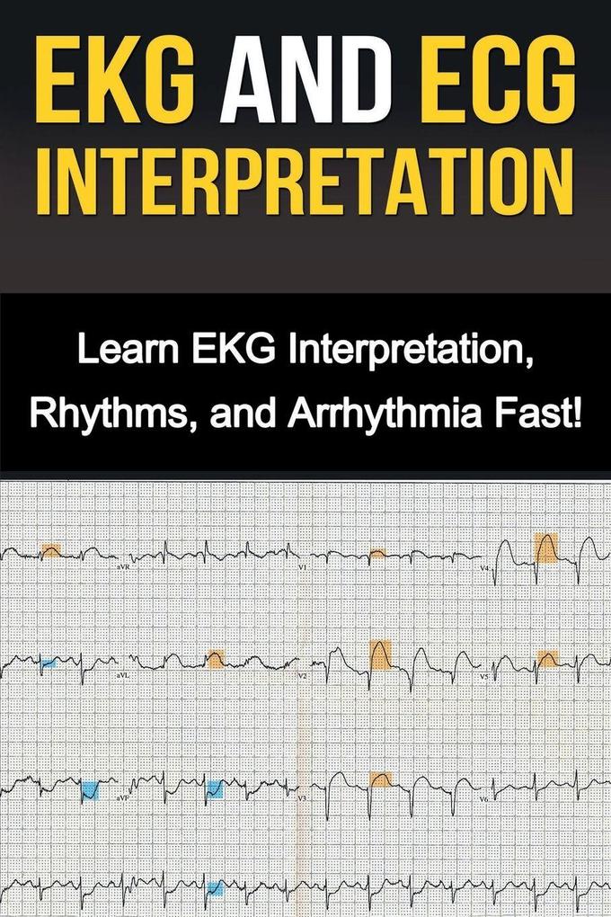 Produktbild: EKG and ECG Interpretation | Alyssa Stone