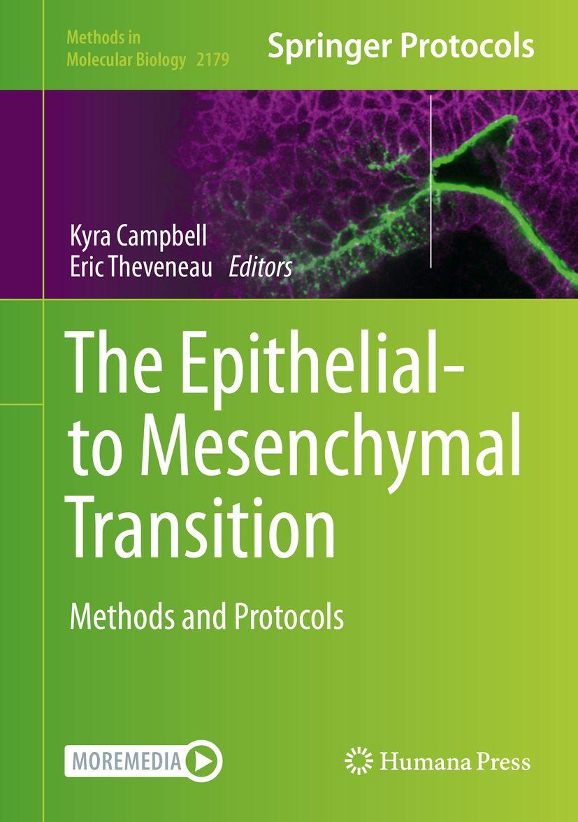 Produktbild: The Epithelial-to Mesenchymal Transition