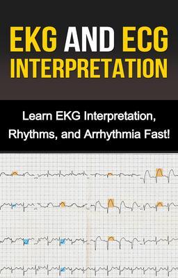 Produktbild: EKG and ECG Interpretation | Alyssa Stone