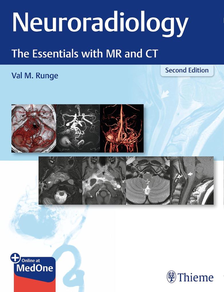 Produktbild: Neuroradiology | Val M. Runge