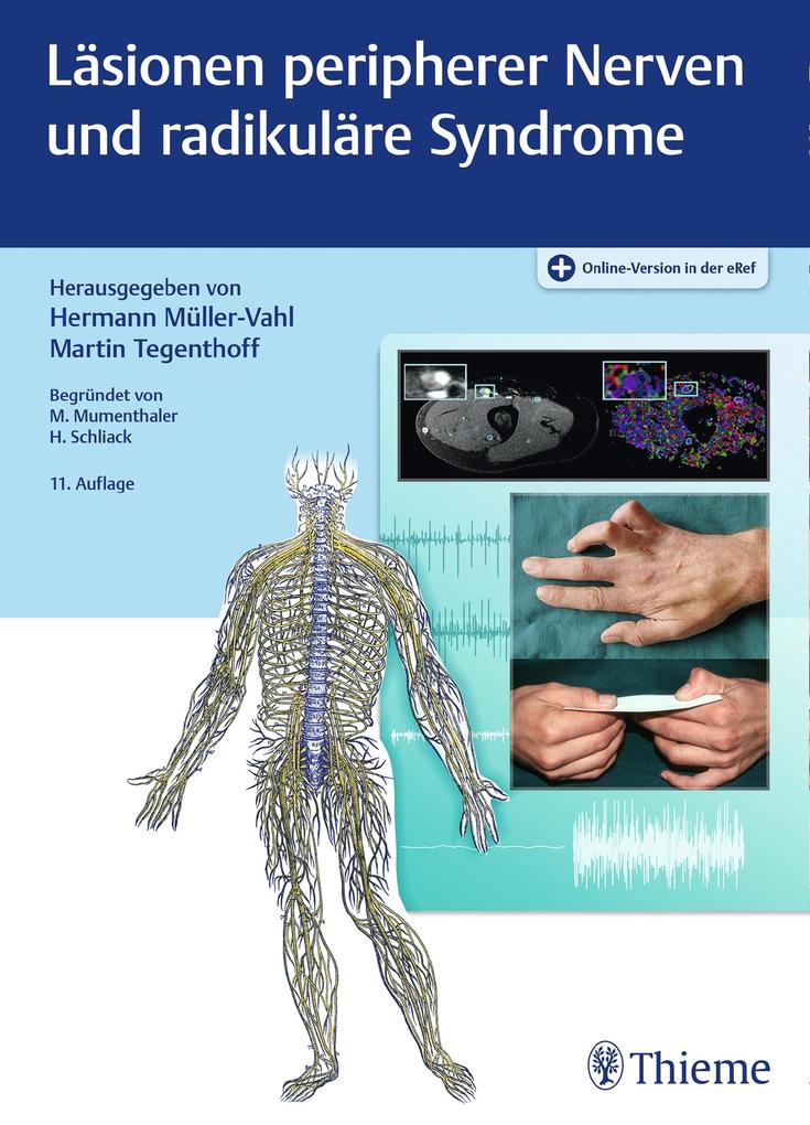 Produktbild: Läsionen peripherer Nerven und radikuläre Syndrome