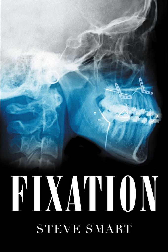 Produktbild: Fixation | Steve Smart
