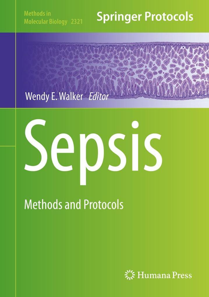 Produktbild: Sepsis