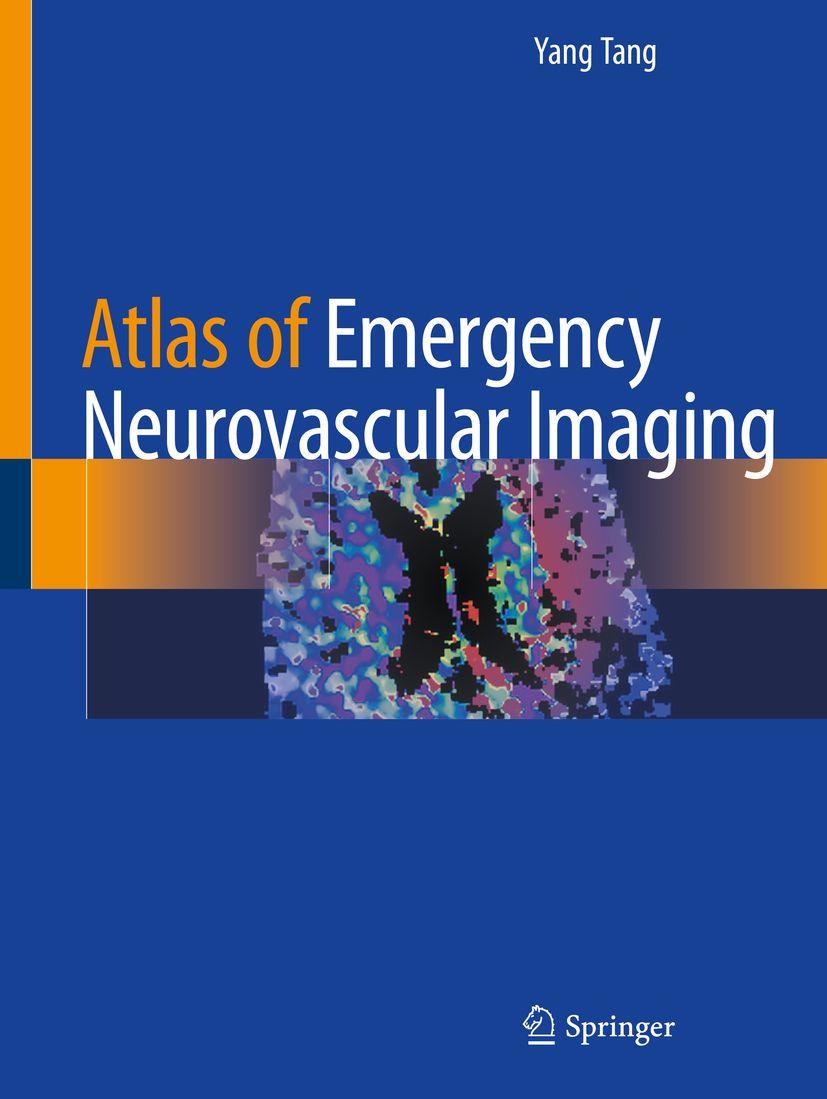 Produktbild: Atlas of Emergency Neurovascular Imaging | Yang Tang