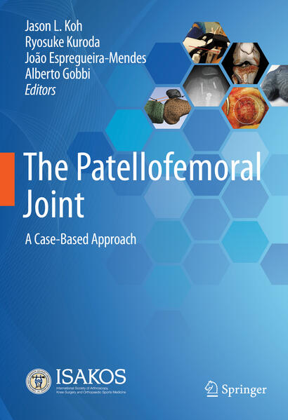 Produktbild: The Patellofemoral Joint