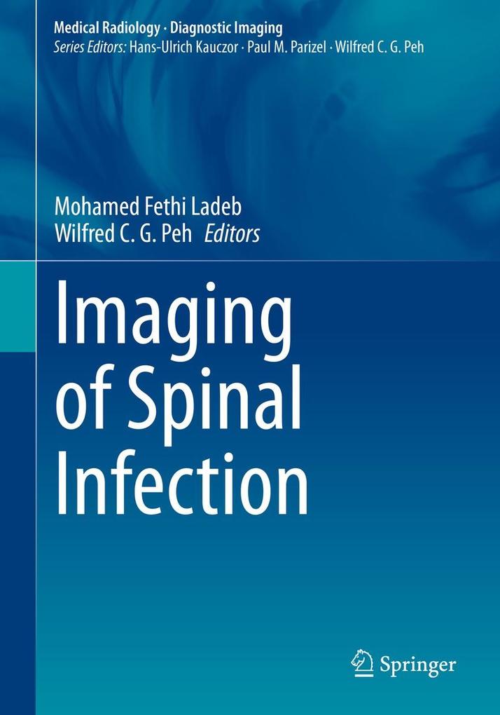Produktbild: Imaging of Spinal Infection