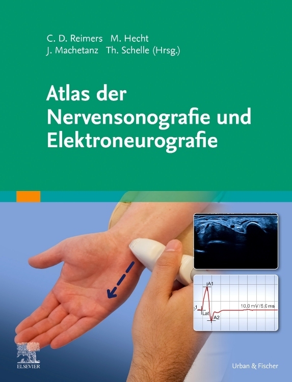 Produktbild: Atlas der Nervensonografie und Elektroneurografie