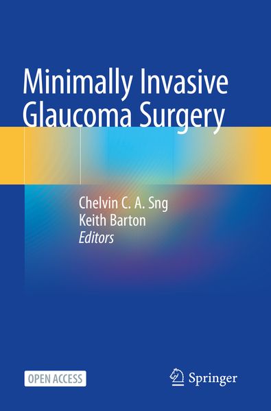 Produktbild: Minimally Invasive Glaucoma Surgery