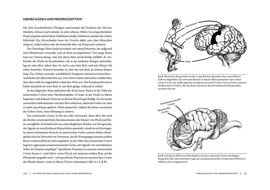 Weitere Ansicht: Horse Brain, Human Brain | Janet L. Jones
