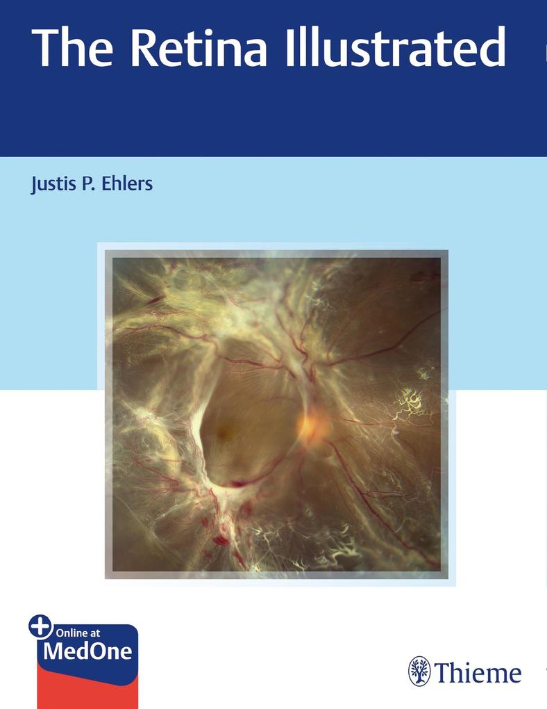 Produktbild: The Retina Illustrated | Justis P. Ehlers