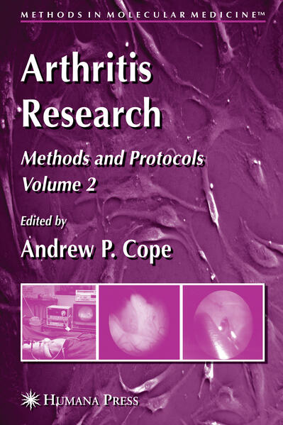 Produktbild: Arthritis Research