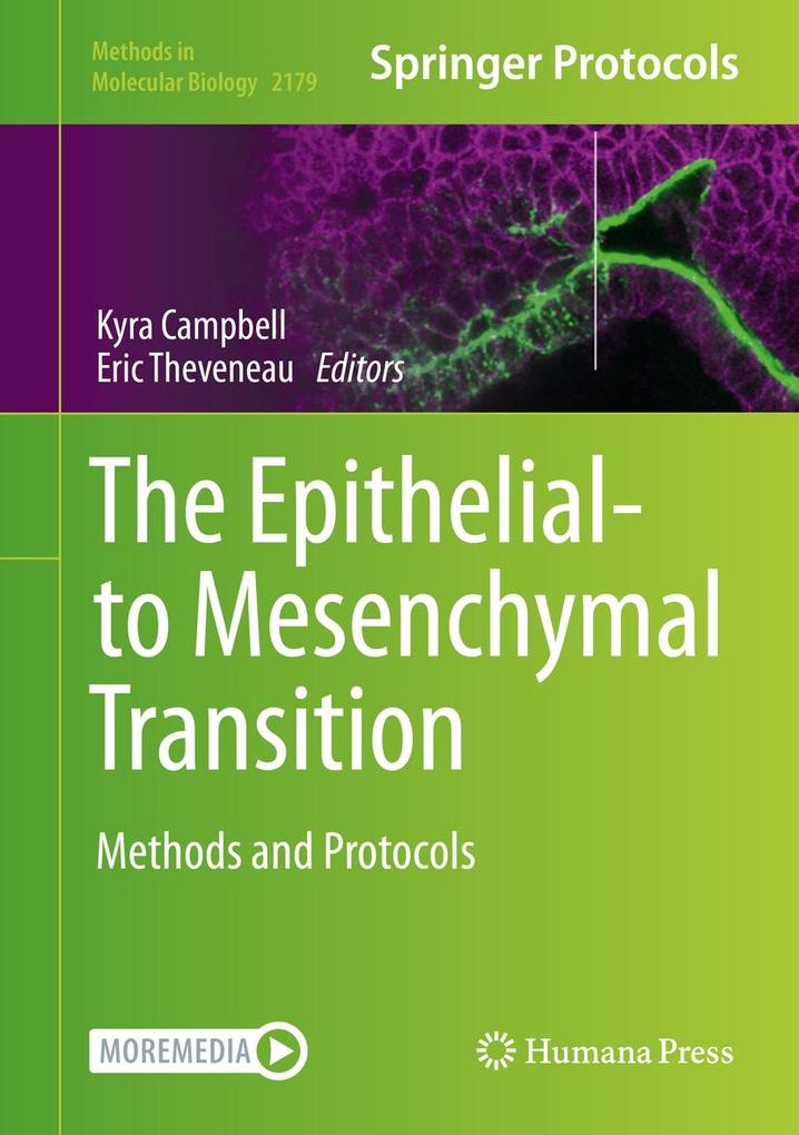 Produktbild: The Epithelial-to Mesenchymal Transition