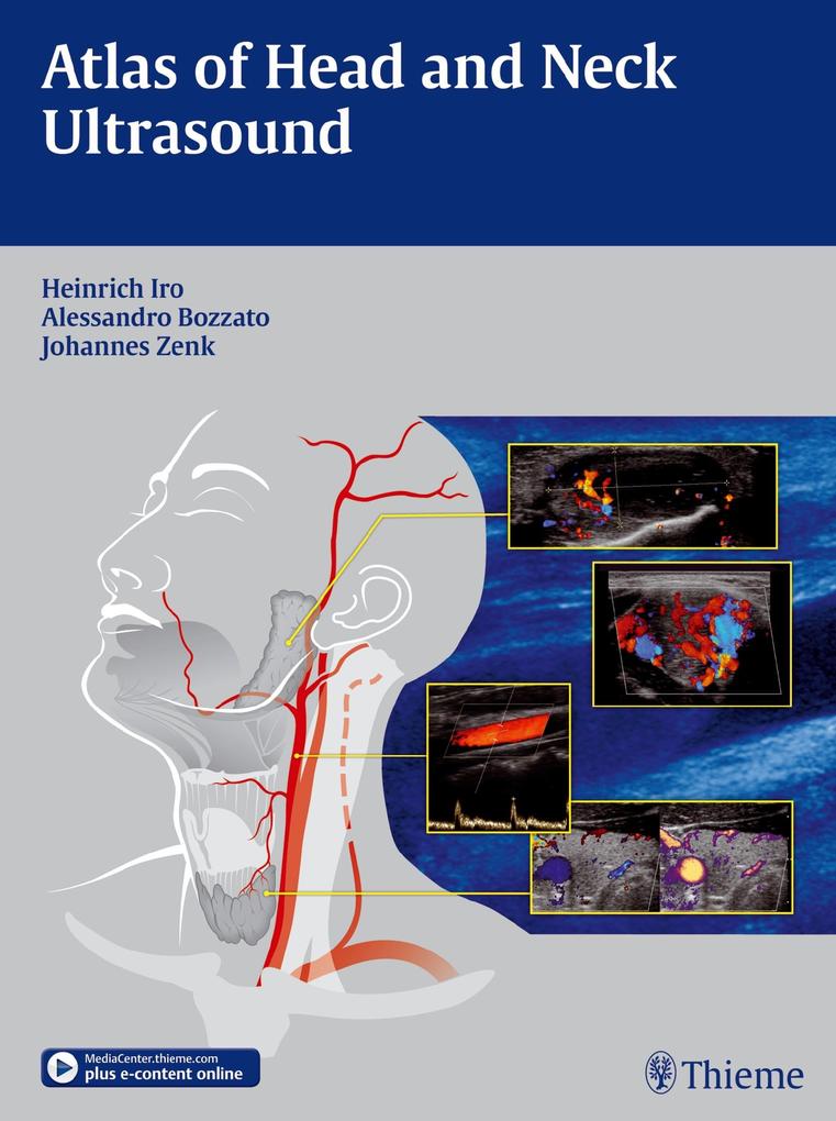Produktbild: Atlas of Head and Neck Ultrasound | Heinrich Iro, Alessandro Bozzato, Johannes Zenk
