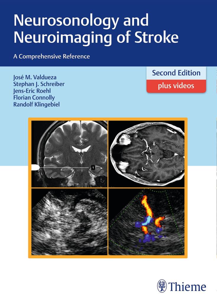 Produktbild: Neurosonology and Neuroimaging of Stroke | José Manuel Valdueza, Stephan Schreiber, Jens-Eric Röhl, Florian Connolly, Randolf Klingebiel