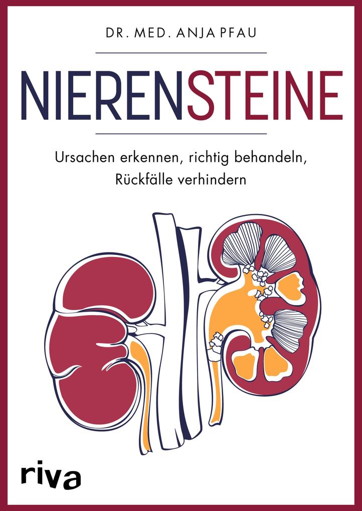 Produktbild: Nierensteine - Ursachen erkennen, richtig behandeln, Rückfälle verhindern | Anja Pfau