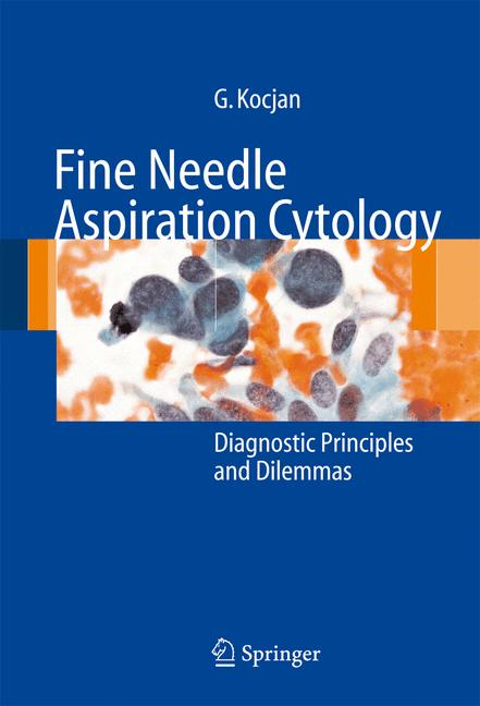 Weitere Ansicht: Fine Needle Aspiration Cytology | Gabrijela Kocjan