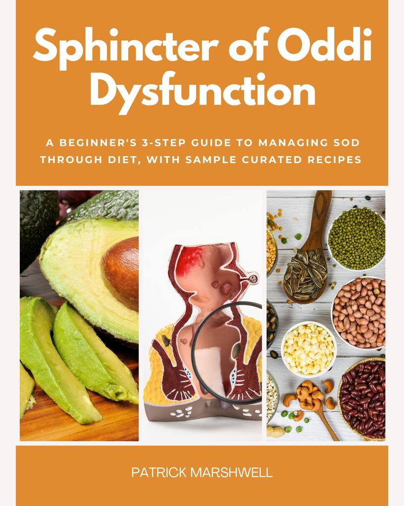 Produktbild: Sphincter of Oddi Dysfunction | Patrick Marshwell