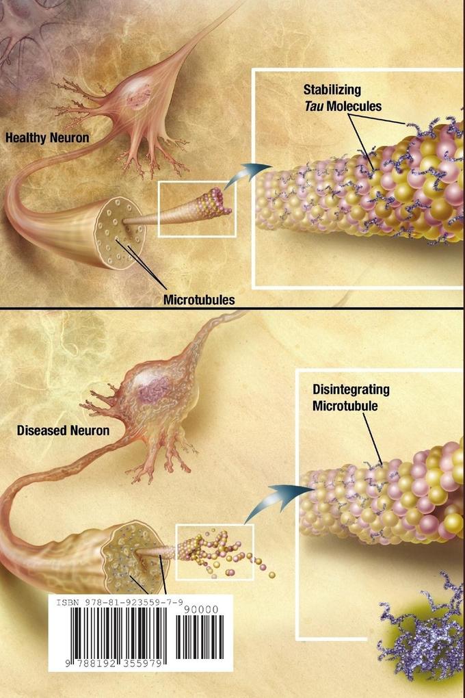 Weitere Ansicht: Brain Function and Dysfunction | Anand Madhu