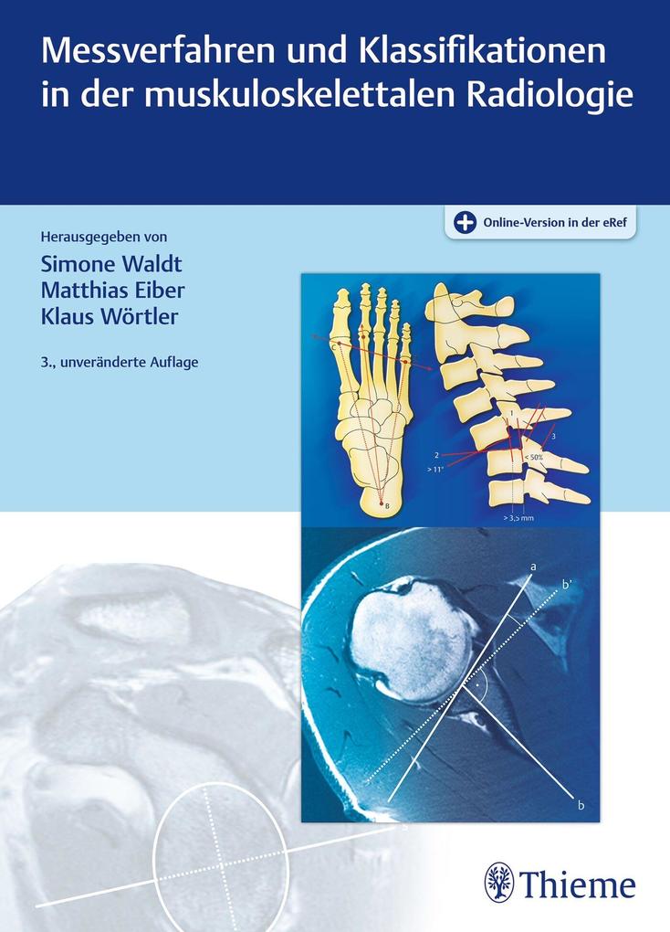 Produktbild: Messverfahren und Klassifikationen in der muskuloskelettalen Radiologie | Simone Waldt, Matthias Eiber, Klaus Wörtler