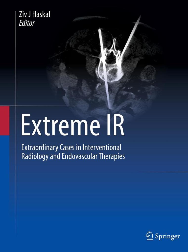 Produktbild: Extreme IR