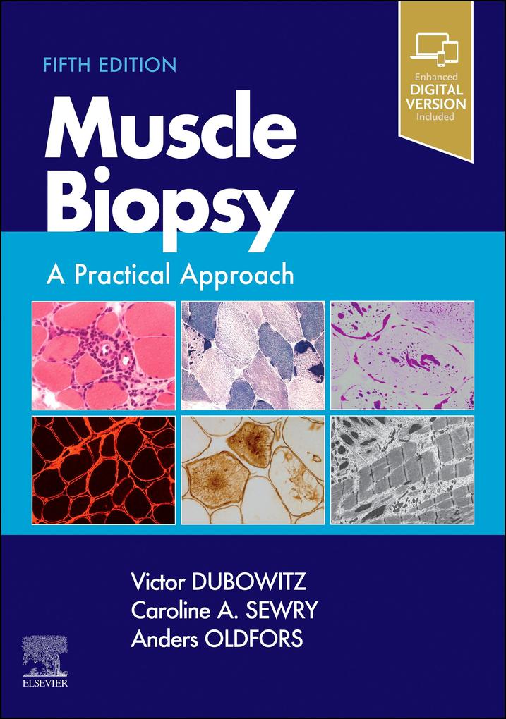 Produktbild: Muscle Biopsy E-Book | Anders Oldfors MD, Sewry BSc, Dubowitz MD