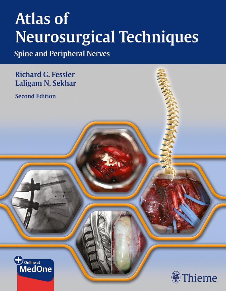 Produktbild: Atlas of Neurosurgical Techniques