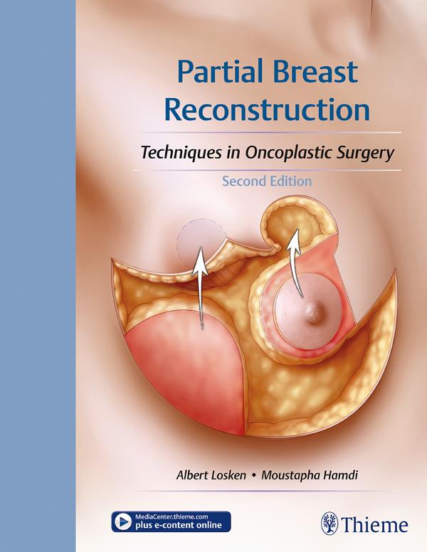 Produktbild: Partial Breast Reconstruction