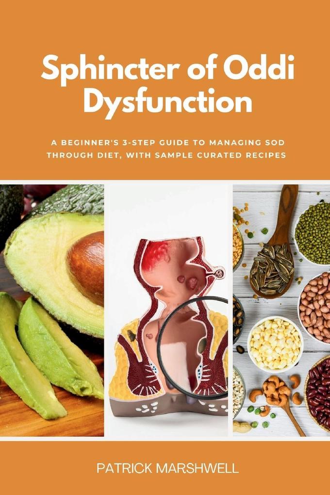 Produktbild: Sphincter of Oddi Dysfunction | Patrick Marshwell