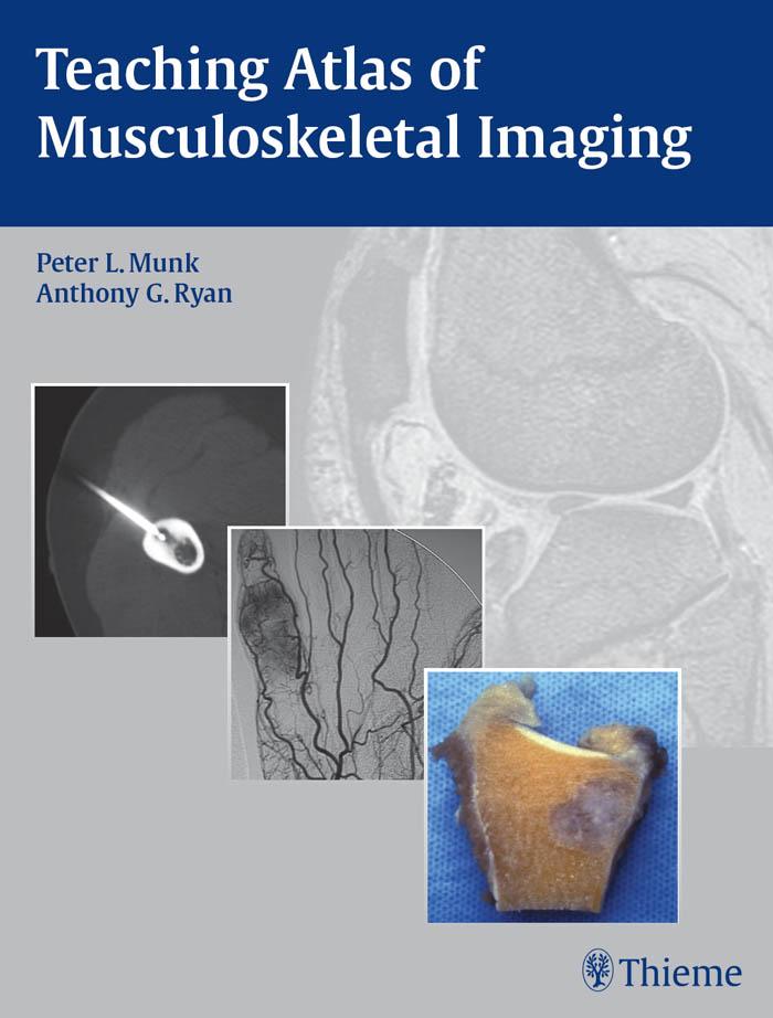 Produktbild: Teaching Atlas of Musculoskeletal Imaging