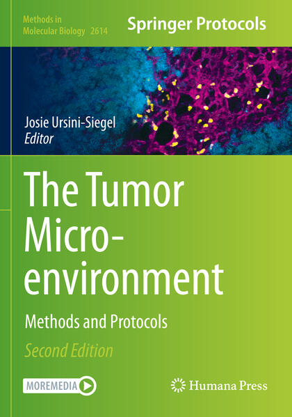 Produktbild: The Tumor Microenvironment