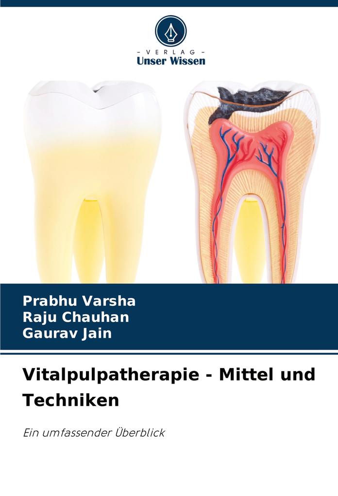 Produktbild: Vitalpulpatherapie - Mittel und Techniken | Prabhu Varsha, Raju Chauhan, Gaurav Jain