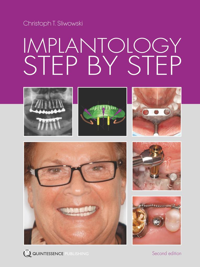 Produktbild: Implantology Step by Step | Christoph T. Sliwowski