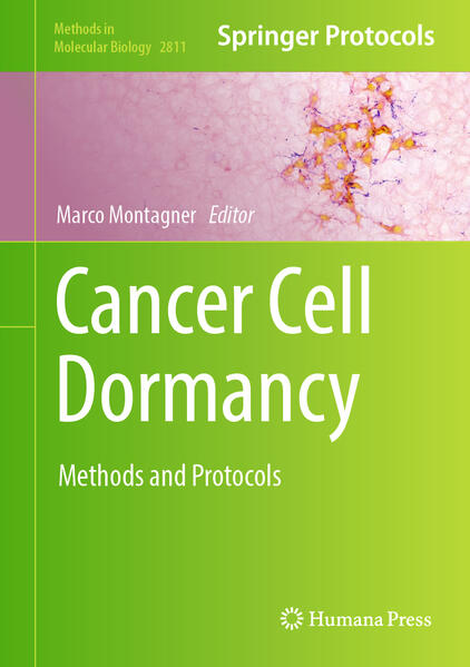 Produktbild: Cancer Cell Dormancy