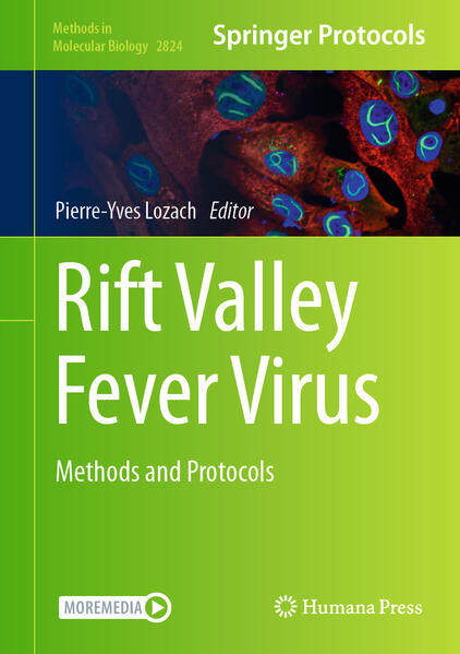 Produktbild: Rift Valley Fever Virus