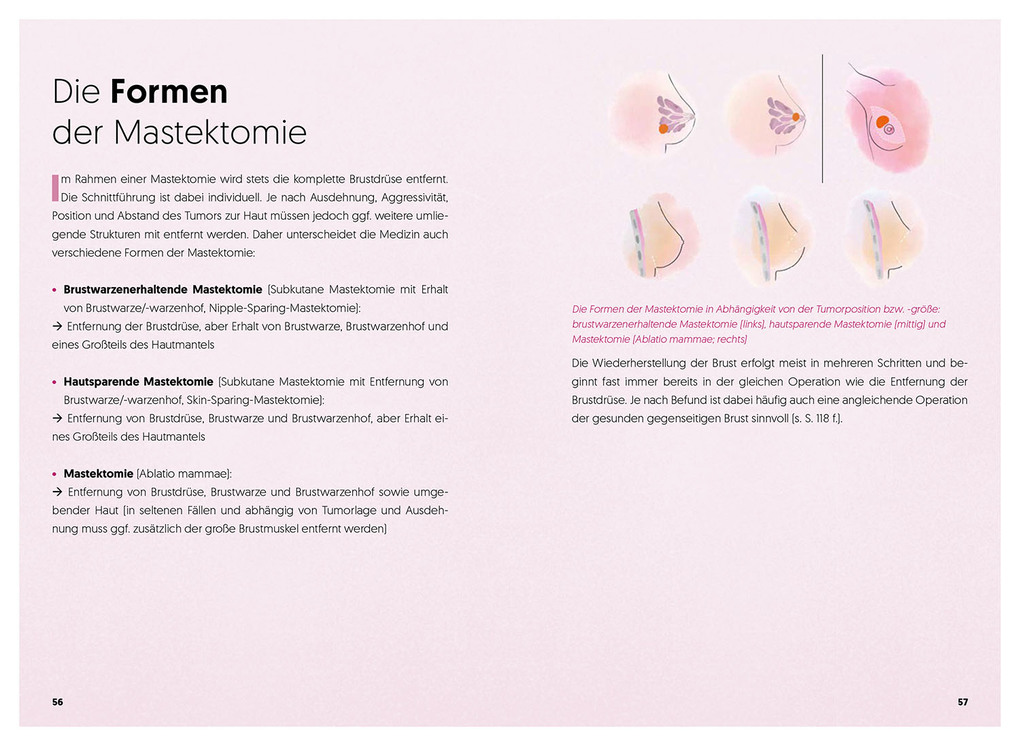 Weitere Ansicht: Diagnose Brustkrebs | Vanessa Tessmann