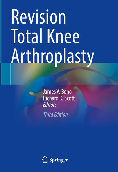 Produktbild: Revision Total Knee Arthroplasty